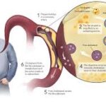 how to reduce cholesterol level