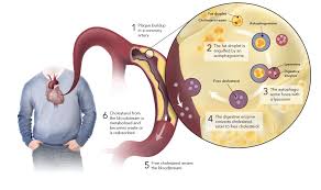 how to reduce cholesterol level