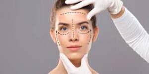 Preservation Rhinoplasty in Dubai