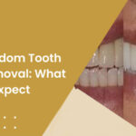Wisdom tooth removal cost Dubai