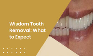 Wisdom tooth removal cost Dubai