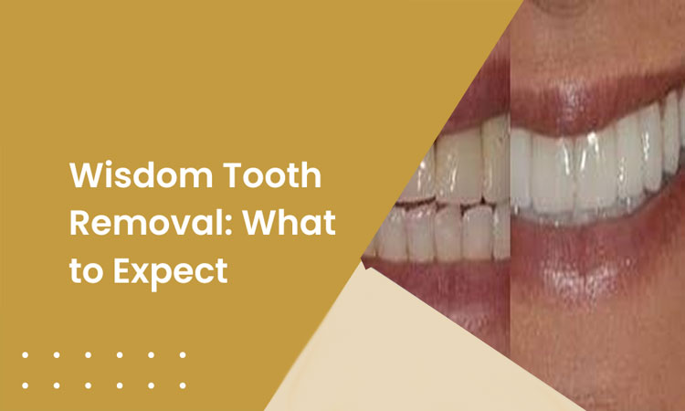 Wisdom tooth removal cost Dubai
