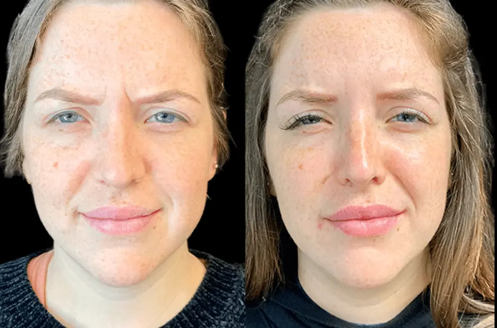 Best Plastic Surgeons in Dubai for Facial Rejuvenation