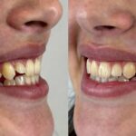 How Orthodontics Improves Smile Aesthetics