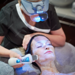 Can Anti-Aging Laser Treatment Help with Sun Damage and Age Spots?