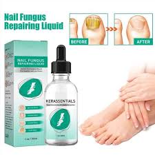 kerassentials reviews