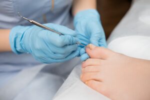 ingrown toenail treatment