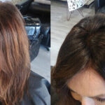 Female-Hair-Loss-system