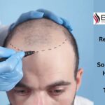 hair restoration clinic