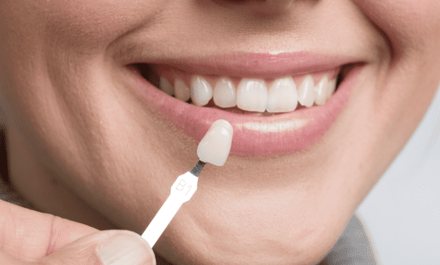 cosmetic dentist dubai