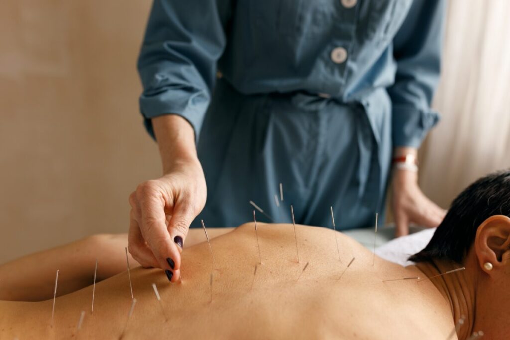 Acupuncture for Pain Management in Philadelphia