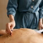 Acupuncture for Pain Management in Philadelphia