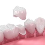 Medically-accurate-digital-illustration-of-dental-crown-scaled
