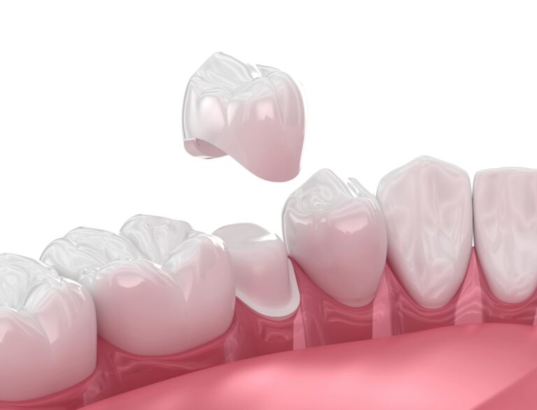 Medically-accurate-digital-illustration-of-dental-crown-scaled