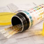 Urinary Symptoms Treatment in Irvine, CA