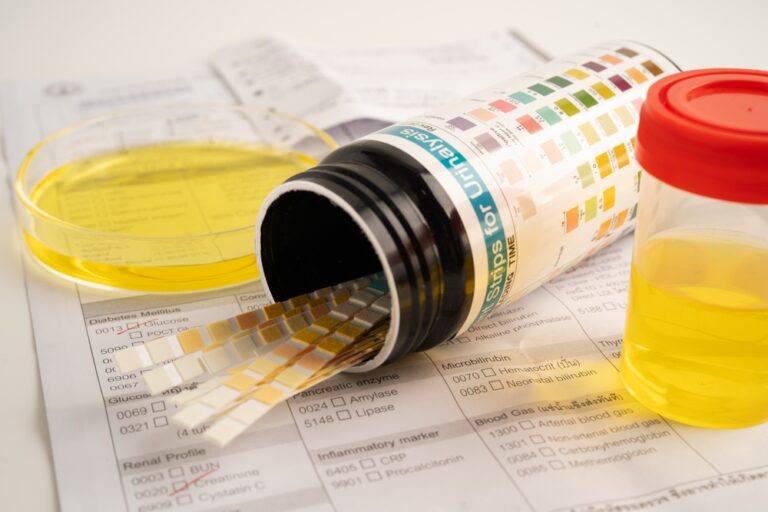 Urinary Symptoms Treatment in Irvine, CA