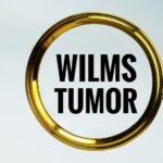Wilms Tumor in Children