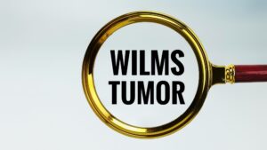 Wilms Tumor in Children