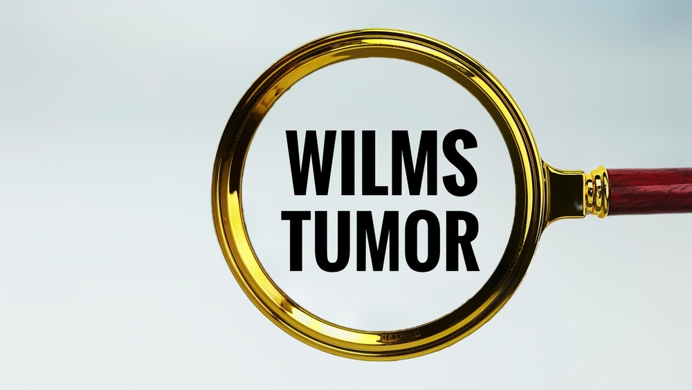 Wilms Tumor in Children