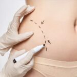 body-contouring-in-Dubai-ezgif.com-webp-to-jpg-converter