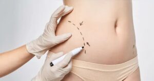 body-contouring-in-Dubai-ezgif.com-webp-to-jpg-converter