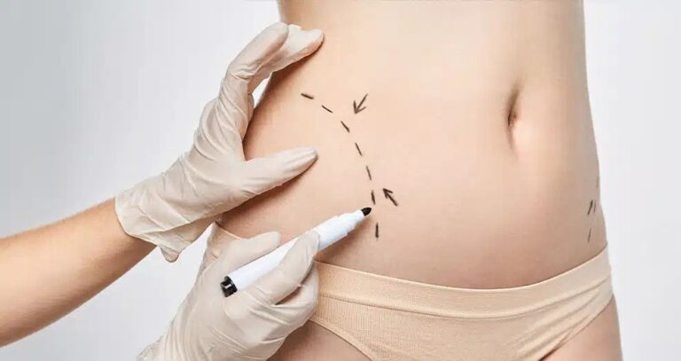 body-contouring-in-Dubai-ezgif.com-webp-to-jpg-converter