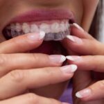 Close-up of female patient wearing braces in dental clinic