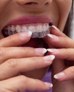 Close-up of female patient wearing braces in dental clinic