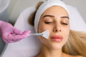 Chemical Peels in Islamabad
