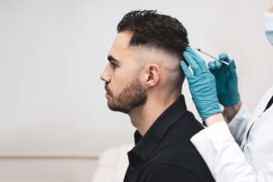 Hair Transplant Service San Antonio