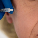 How Profhilo Treatment in Dubai Enhances Natural Beauty