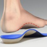 Ingrown Toenail Surgery & Orthotics Guide Townsville