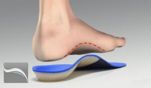 Ingrown Toenail Surgery & Orthotics Guide Townsville