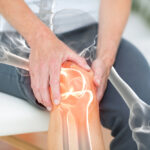 Arthritis Relief Supplement