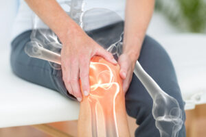 Arthritis Relief Supplement