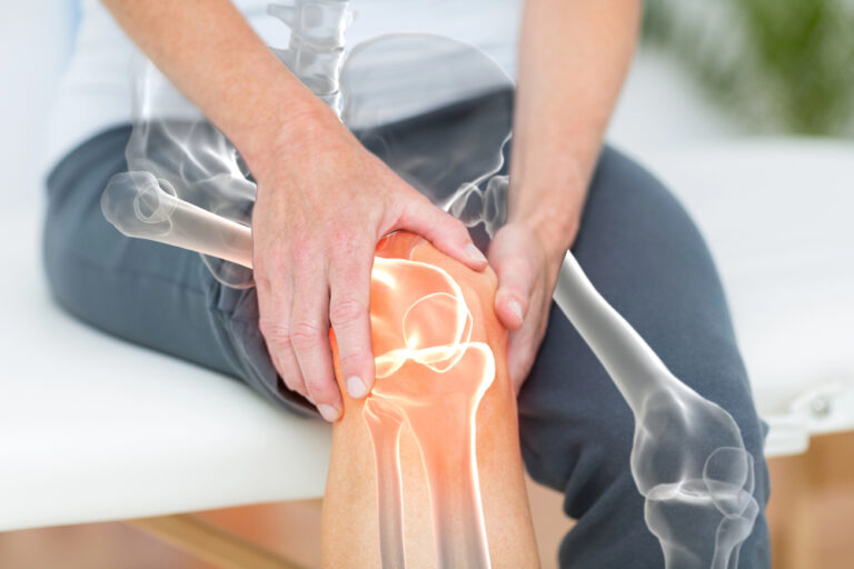 Arthritis Relief Supplement