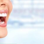 Best-Teeth-whitening-in-Hamilton