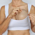 Breast Augmentation in Islamabad
