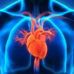 Heart Problems