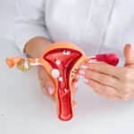 Uterine Fibroid Embolization in Van Nuys, CA