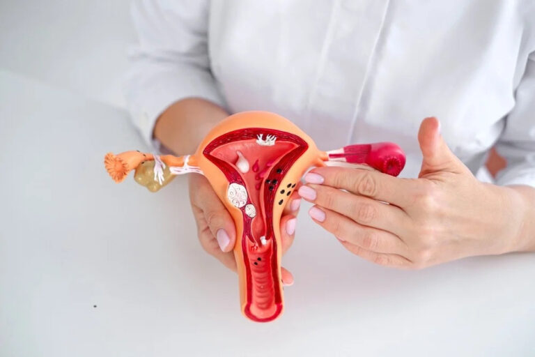 Uterine Fibroid Embolization in Van Nuys, CA
