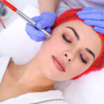 acne-treatment