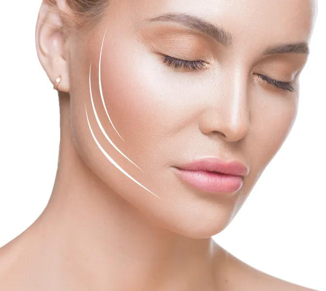 Endolift in London