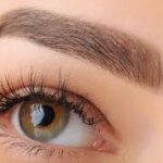 eyebrow hair transplant in Dubai