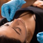 Professional,Therapist,In,Blue,Gloves,Applying,Acupuncture,Needles,To,A