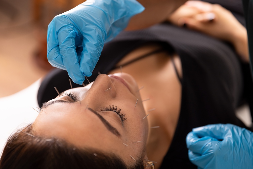 Professional,Therapist,In,Blue,Gloves,Applying,Acupuncture,Needles,To,A