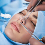 rhinoplasty in utah