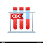 CBC Blood Test Price in Lahore