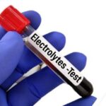 Electrolytes Test in Lahore