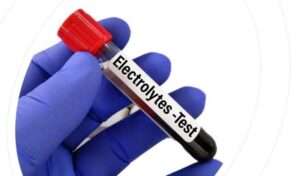 Electrolytes Test in Lahore